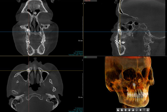 DMI Pachuca Diagnóstico Maxilofacial por Imágenes