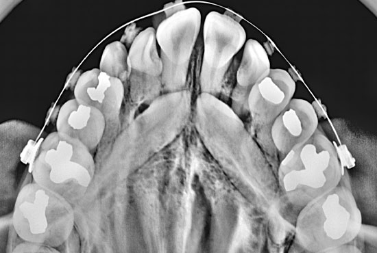DMI Pachuca Diagnóstico Maxilofacial por Imágenes