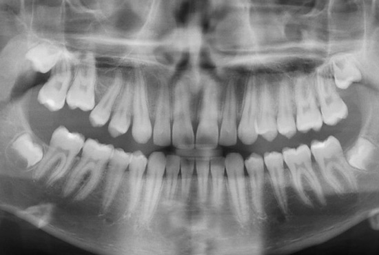 DMI Pachuca Diagnóstico Maxilofacial por Imágenes