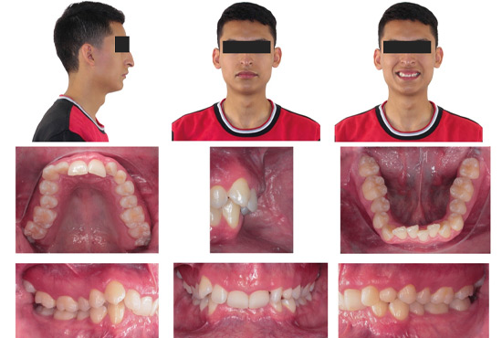 DMI Pachuca Diagnóstico Maxilofacial por Imágenes