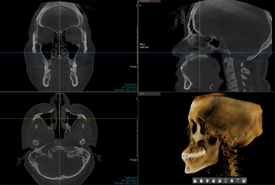 DMI Pachuca Diagnóstico Maxilofacial por Imágenes