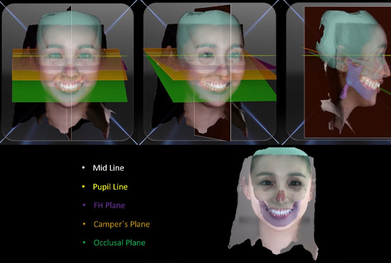 DMI Pachuca Diagnóstico Maxilofacial por Imágenes