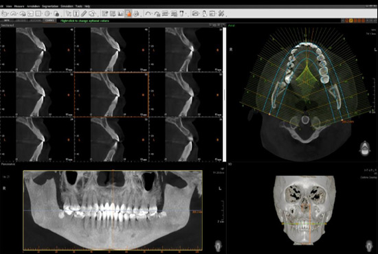 DMI Pachuca Diagnóstico Maxilofacial por Imágenes