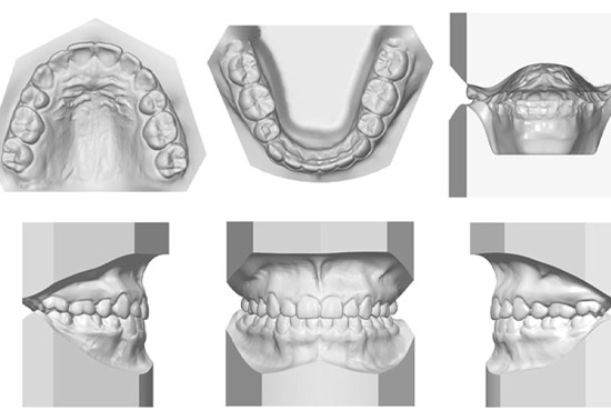 DMI Pachuca Diagnóstico Maxilofacial por Imágenes